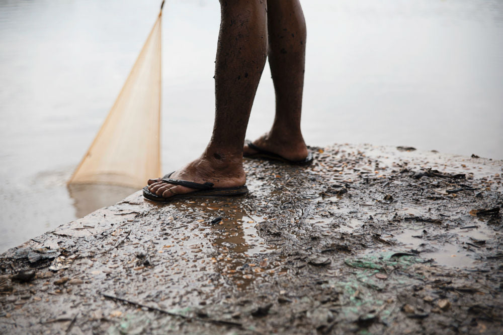 Those Cheap Flip Flops Are Terrible For Your Feet